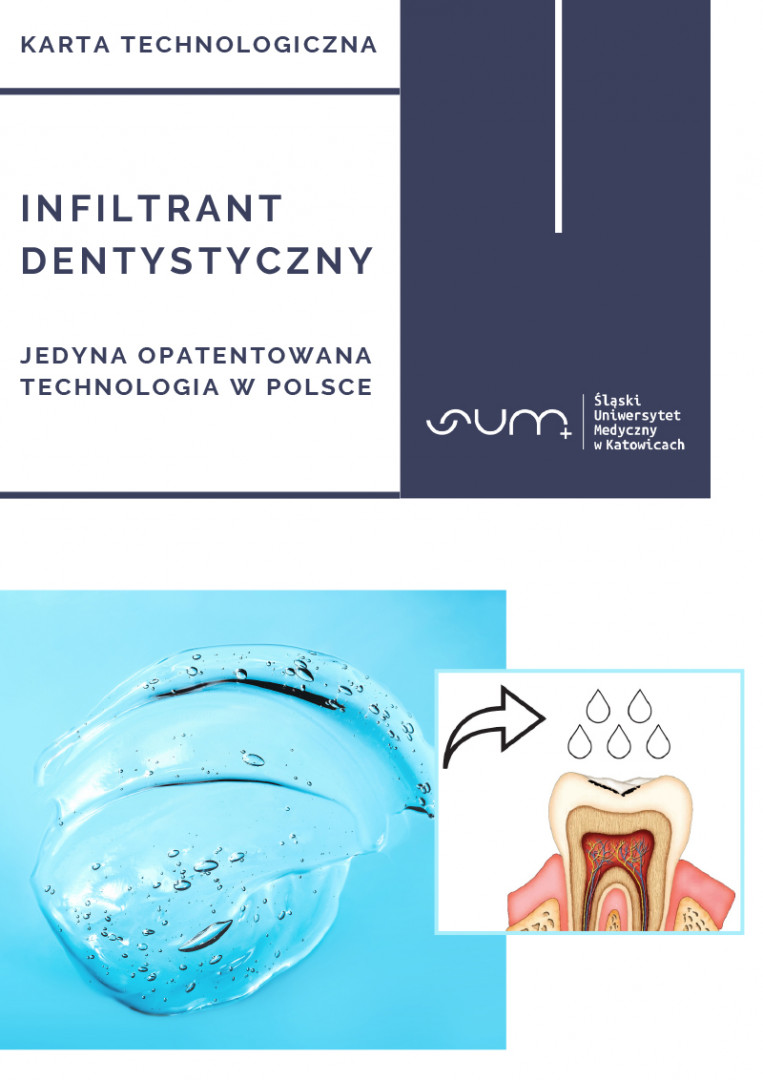 INFILTRANT DENTYSTYCZNY JEDYNA OPATENTOWANA TECHNOLOGIA W POLSCE